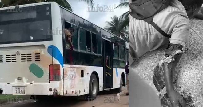 Libreville : Un élève du lycée technique se coupe le bras droit à bord d’un bus scolaire